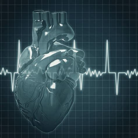 Cardiac Arrhythmia Cardiovascular Medical Group Of Southern California