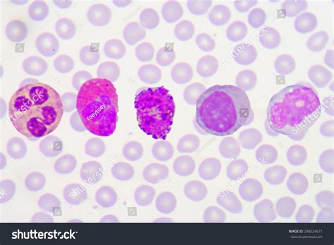 Wbc Is Are Composed Of Granulocytes Neutrophils Eosinophils And