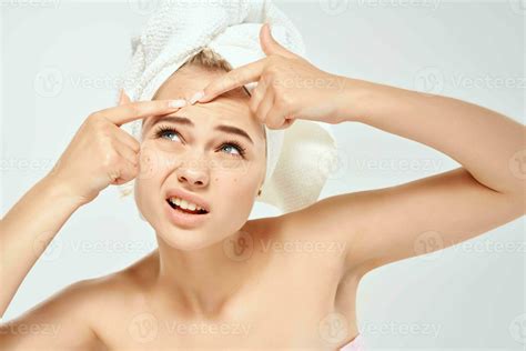 Woman With Bare Shoulders With A Towel On Her Head Squeezes Out Pimples