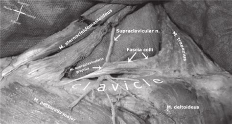 Supraclavicular Fossa Anatomy