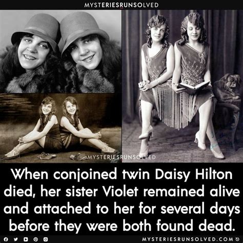 Daisy And Violet Hilton The Incredible Heartbreaking Story Of The