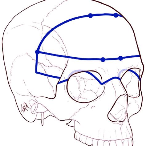 Anatomic Representation Of The Anterior Cranial Fossa Acf A