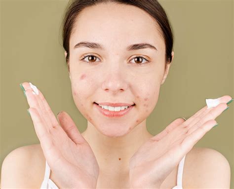 Best Quick Tips To Get Rid Of Acne Problems Easily