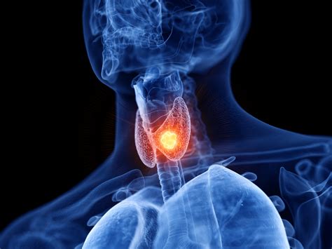 Thyroid Nodule Causes Diagnosis And Treatment Apollo Hospitals Blog