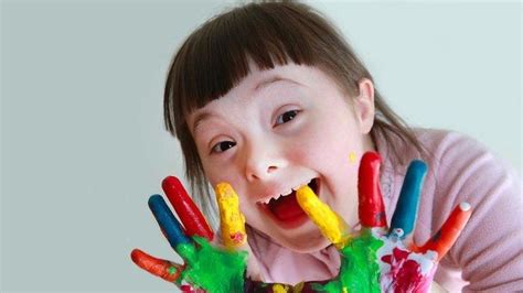 Hari Sindrom Down Sedunia Mengenal Kelainan Genetik Down Syndrome Beda Dengan Autis Halaman