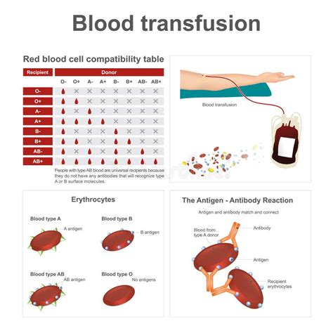 Transfusion Sanguine Illustration De Vecteur Illustration Du Flux