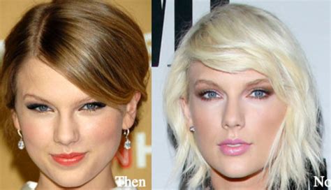Taylor Swift Plastic Surgery Before And After Photos Latest Plastic