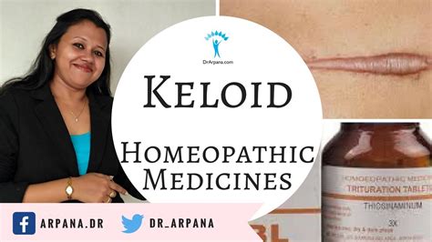 कीलोइड के कारन व होम्योपैथिक इलाज Keloid Best Homeopathic Medicines