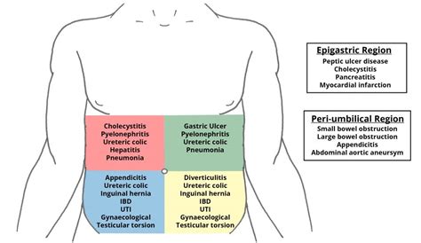 The Acute Abdomen Causes Management Teachmesurgery