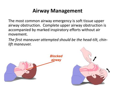 Ppt Respiratory Aandp Abgs Assessment Respiratory Case Studies