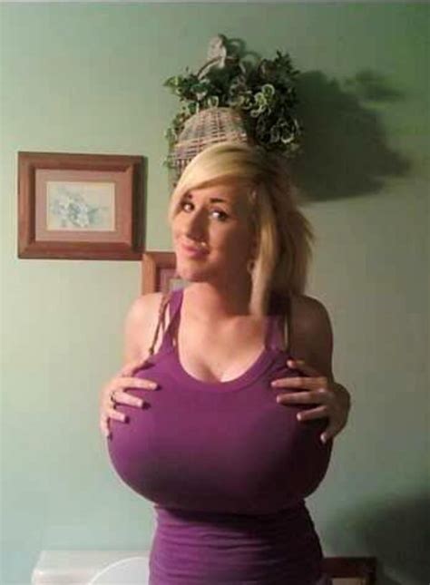 Yulia Nova Morph Breast Reduction