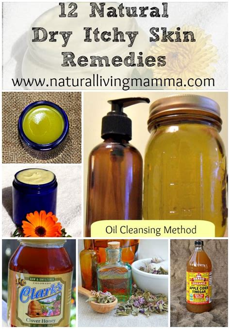 12 Natural Dry Itchy Skin Remedies Natural Living Mamma Dry Itchy