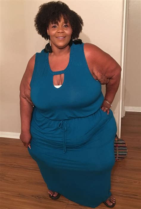 Former Fattest Woman In The Worlds Incredible Forty Stone Weight Loss