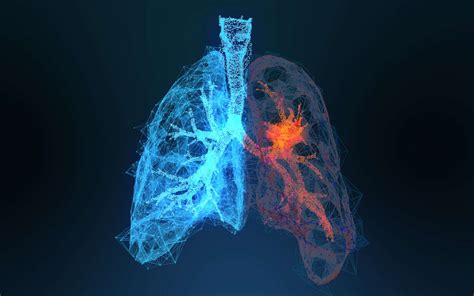Why Are Lung Cancers Becoming More Common In Women And Non Smokers