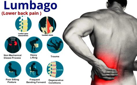 Lumbar Spine Pain Lumbago And Effective Treatment With Lumbar Support