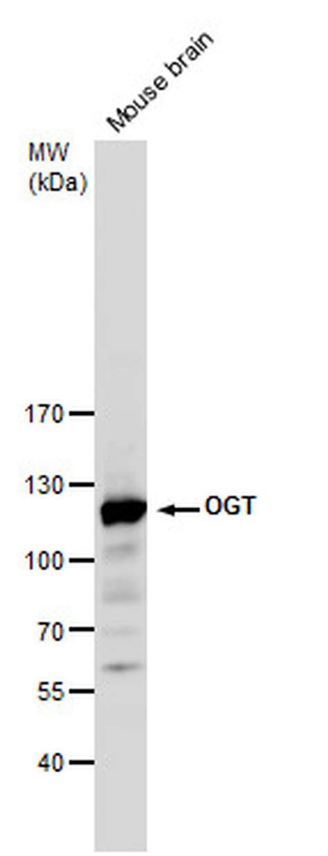 Ogt Polyclonal Antibody Pa5 22071
