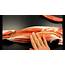 Upper Leg Tendon Anatomy / Muscles In The Lateral Compartment Of 