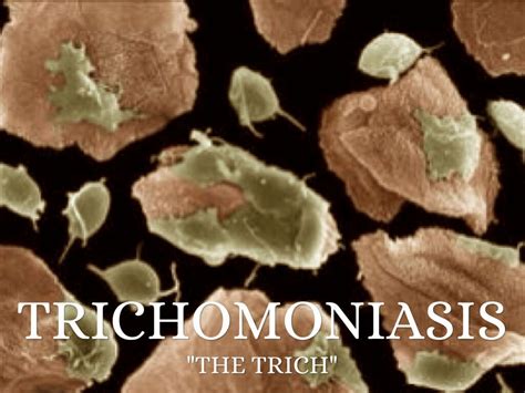 Trichomoniasis What Is Trichomoniasis