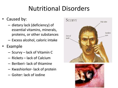 Ppt Disease And Disease Producing Organisms Powerpoint Presentation
