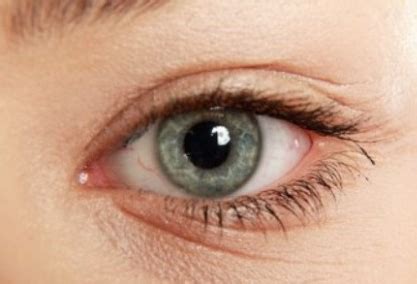 Under eye wrinkles is one of the first signs of aging and can be hard to get rid of. How to get rid of under Eye Wrinkles, Overnight, Fast ...