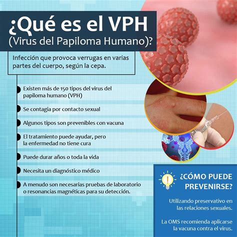 El Virus Del Papiloma Dra Alejandra González Guidos Facebook