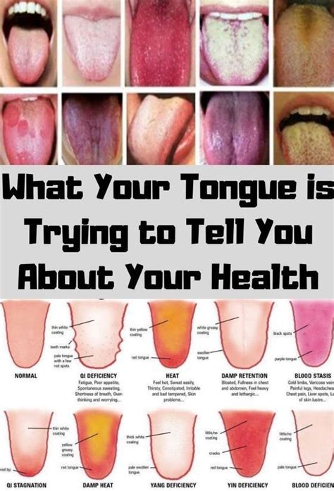 What Your Tongue Is Trying To Tell You About Your Health Tongue Health Healthy Tongue Health