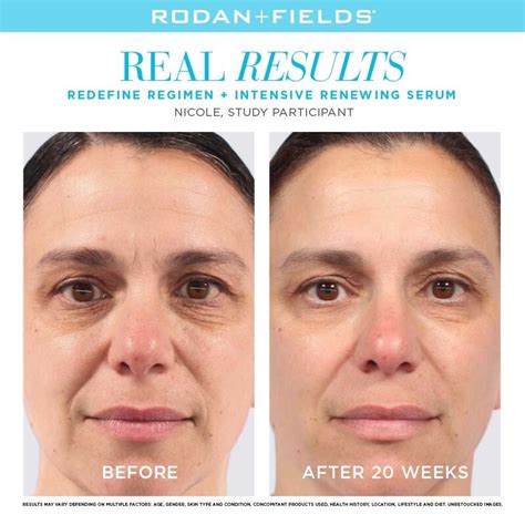 Rodan Fields Before And After Photos Stories Shopping And Info
