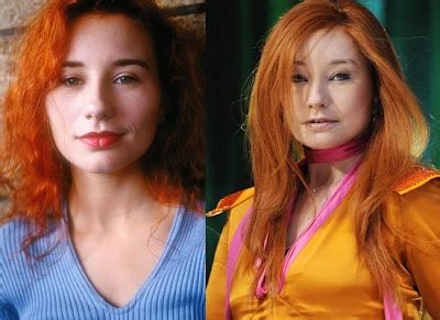 Tori Amos Plastic Surgery Before And After Nose Job And Botox Plastic Surgery