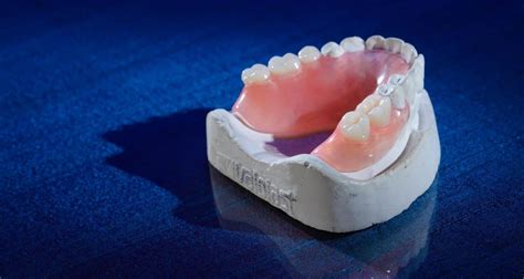 what are flexible dentures algodones dentists guide