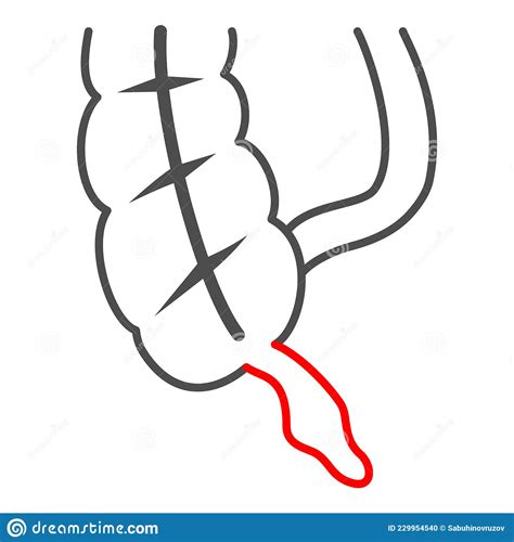 Appendicitis Inflamed Appendix Labeled Chart Cartoon Vector