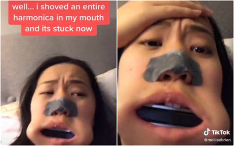 Teen Goes Viral On Tiktok After A Harmonica Got Stuck In Her Mouth