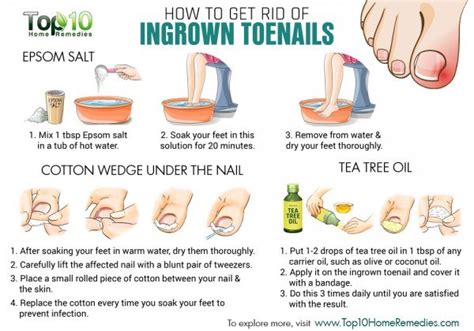 Prevention for cat ingrown nail. Home Remedies for Ingrown Toenails | Top 10 Home Remedies