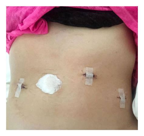 Tara Lipinski Says Shes ‘lucky Amid Endometriosis Battle