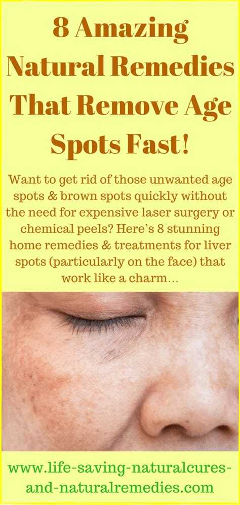 Best Natural Remedies And Home Treatments For Age Spots And Liver Spots
