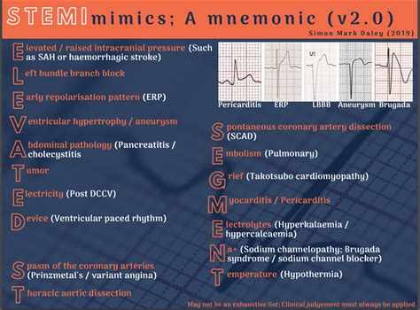 STEMI Mimics A Mnemonic V2 Fab NHS Stuff