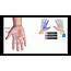 Branches Of The Ulnar & Median Nerves In Hand  YouTube