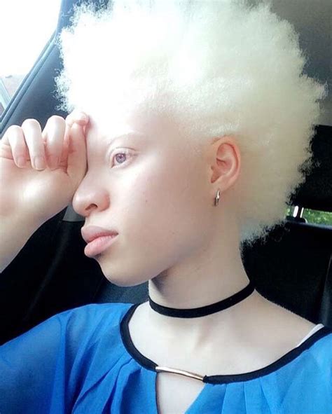 Just Us Black Women Albino Girl Beauty Natural Hair Styles