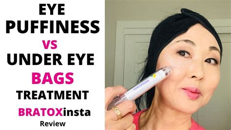 Treatment For Under Eye Puffiness Vs Under Eye Bags Bratoxinsta Review Youtube