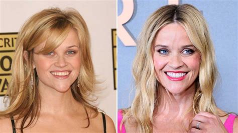 Reese Witherspoon Chin Before And After