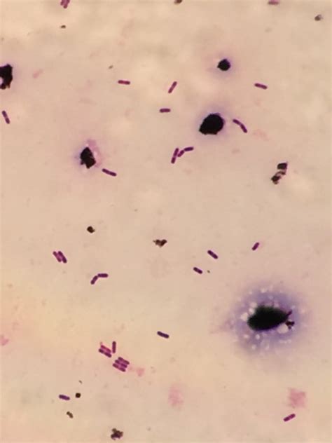 However, with older cultures the gram stain reaction can be variable and also cells may appear. Listeria monocytogenes〔リステリア〕 | グラム染色: Gram Stain