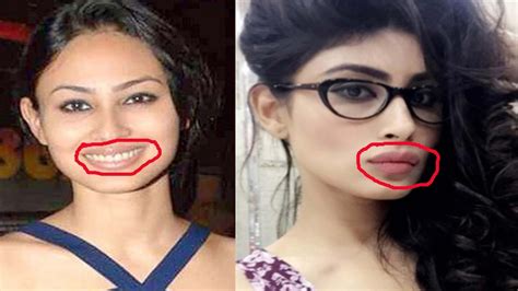 top 10 plastic surgery photos of popular tv actresses before and after