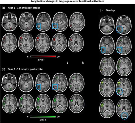 Functional Neuroimaging Findings Download Scientific Diagram