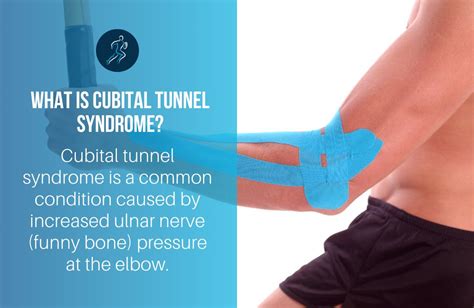 Cubital Tunnel Syndrome Physio Australian Sports Physio