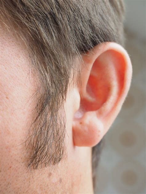Sideburn Restoration Everything You Need To Know