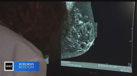 New Breast Cancer Treatments Helping Patients Live Longer And Healthier