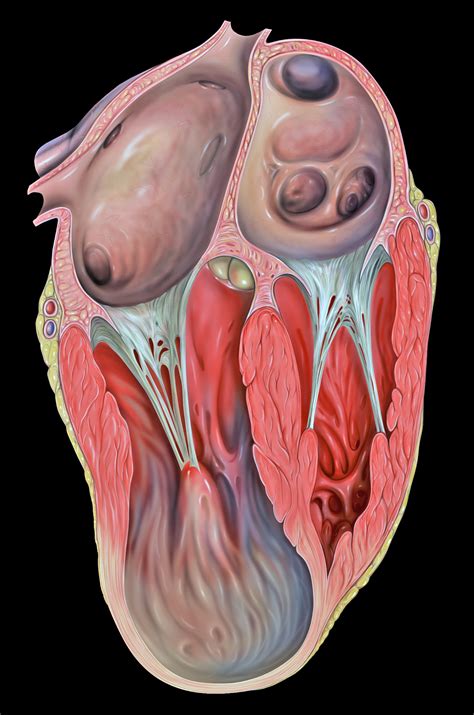 Many have no symptoms and are not dangerous. Heart Aneurysm