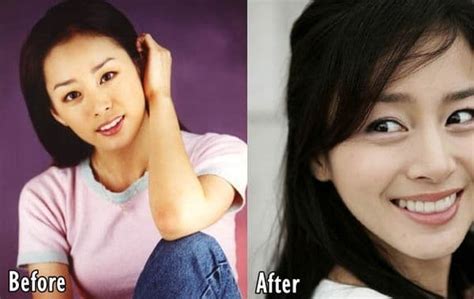 Based on the survey, south korea placed as the number one country which has the highest plastic surgery demand. Kim Tae Hee Before And After Plastic Surgery