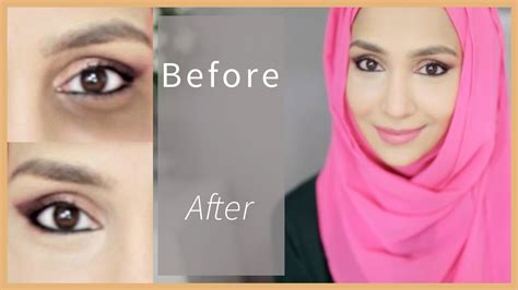 How To Hide Black Circles Under Eyes Without Makeup Saubhaya Makeup
