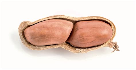 Giving Peanut Based Foods To Babies Early Prevents Allergies Research