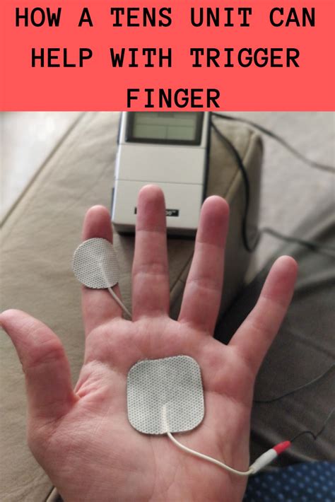 How To Use A Tens Unit For Trigger Finger Optimize Health 365